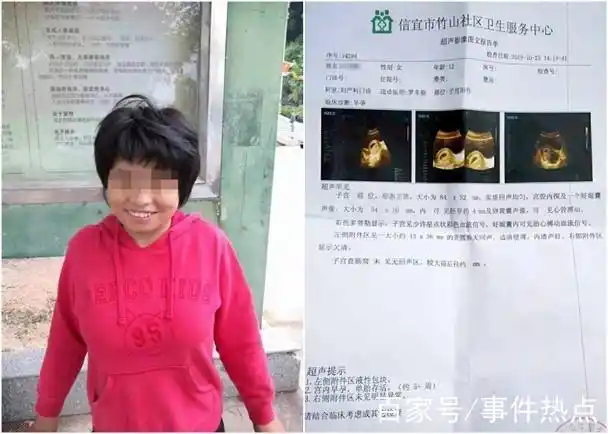 广东一名12岁智障女童两度怀孕,八旬老汉向警方承认性侵事实