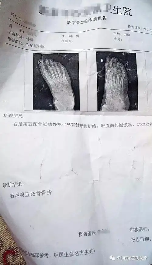 佑三调理右足第五趾骨骨折20天活动自由痊愈如初