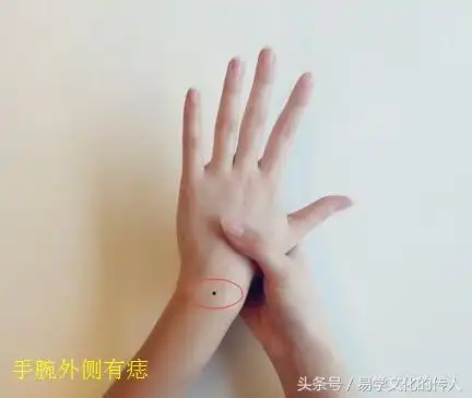 男人女人手腕长痣有什么意义?对人生运势是否有影响?