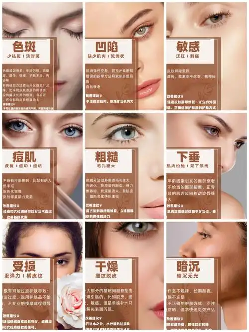 这些问题不知你有没有中招啊?#皮肤管理海报  #面部拨