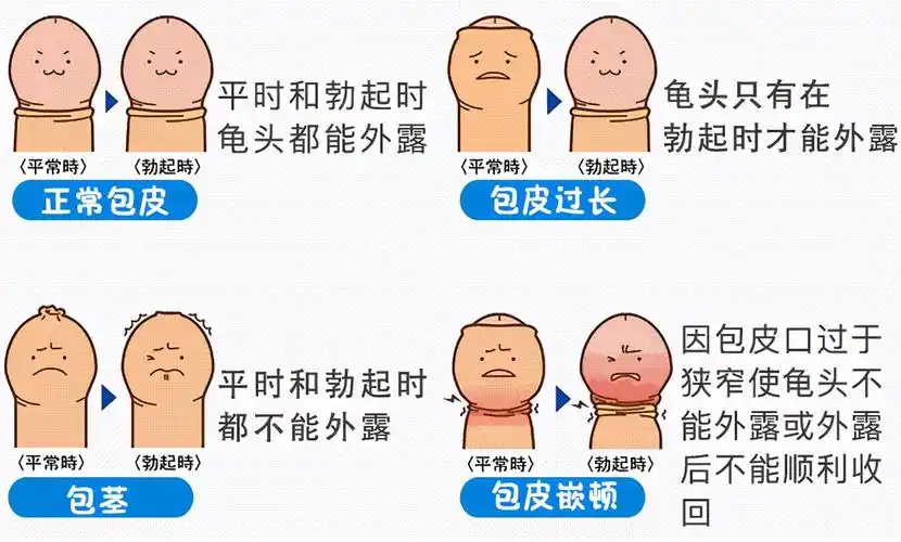 无痛割包茎手术多少钱(包皮过长到底切不切) - 嗨哟百科网