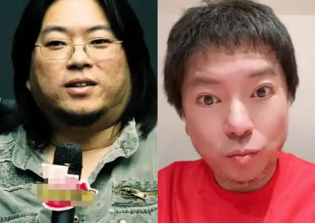 高晓松晒暴瘦自拍头发剪短下巴尖细似华晨宇眼睛突出疑甲亢