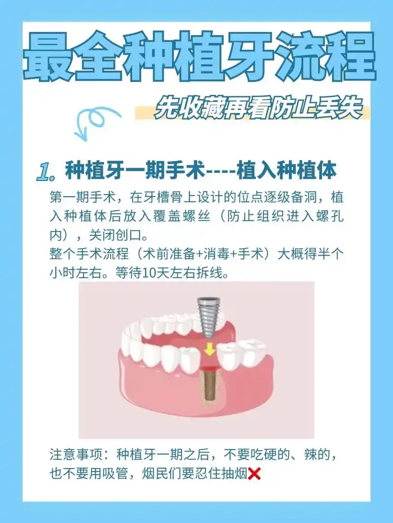 种植牙需要了解的详细流程,先收藏 - 抖音