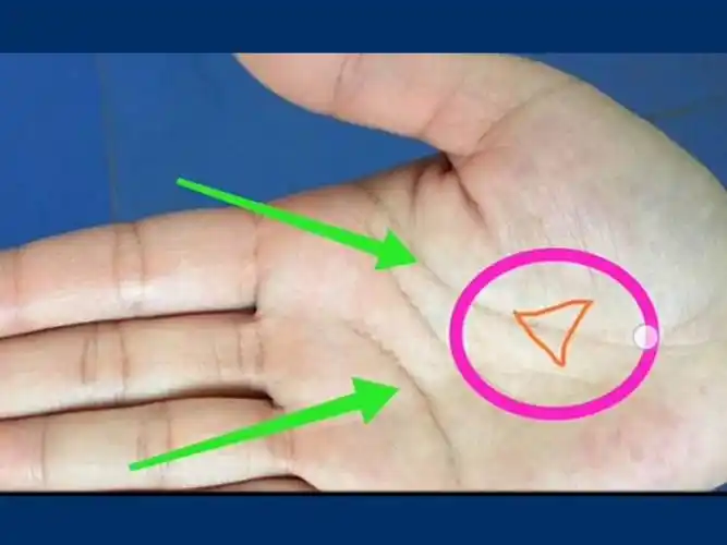 生命线上出现"三角纹"的手相