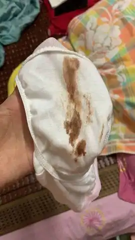 怀孕30天今晚突然内裤有好多血,好害怕,不知道是不是先兆流产?