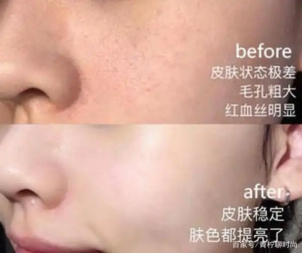 袁咏仪同款面霜,补水保湿,用后皮肤水润细腻