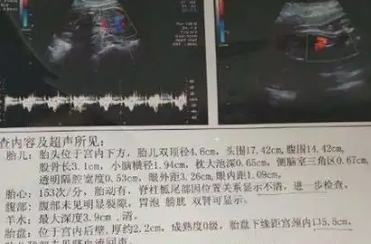b超单上的3组"数据",或许是胎儿在告知准爸妈自己是个男宝_进行_宝宝