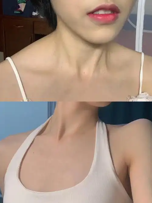 为各位辣妹奉上我的斜方肌消除术60