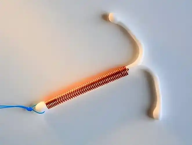 女性放节育环到底是好是坏,利弊如何,真必要吗?医生一文说清