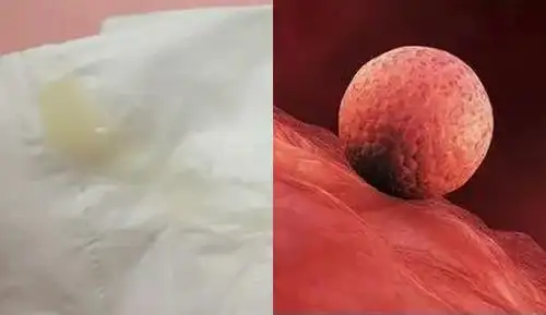 着床成功排出白带图片什么样子