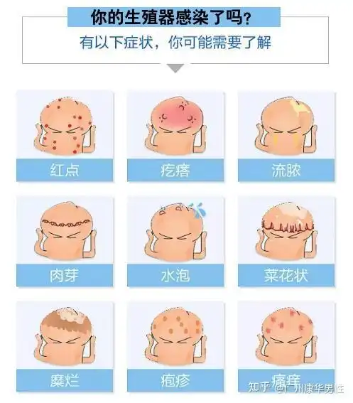 龟头炎由于不结性交或者是不做好卫生清洁易受到葡萄球菌,真菌,白色