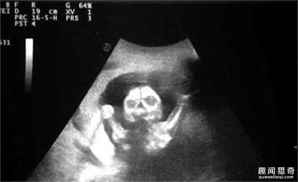 准妈妈去体检,看到b超下的婴儿差点吓哭!