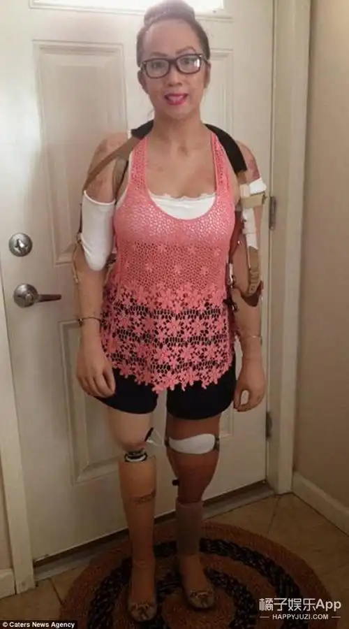 自称"塑料模特",第一个走上纽约时装周t台的假肢女孩!