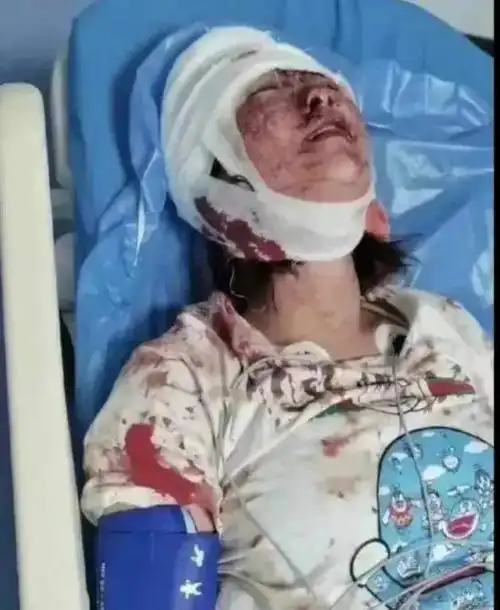 何炅曾被醉汉暴打吴彦祖也被爆头网友成龙张雨绮骂人没有错