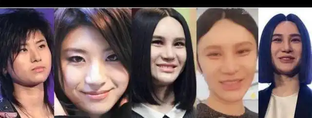 说说那些整容失败的明星,你觉得是哪个最丑?