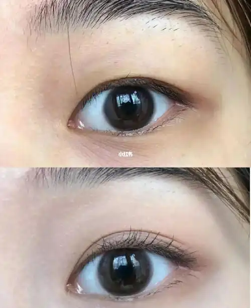 敲级隐形的双眼皮贴