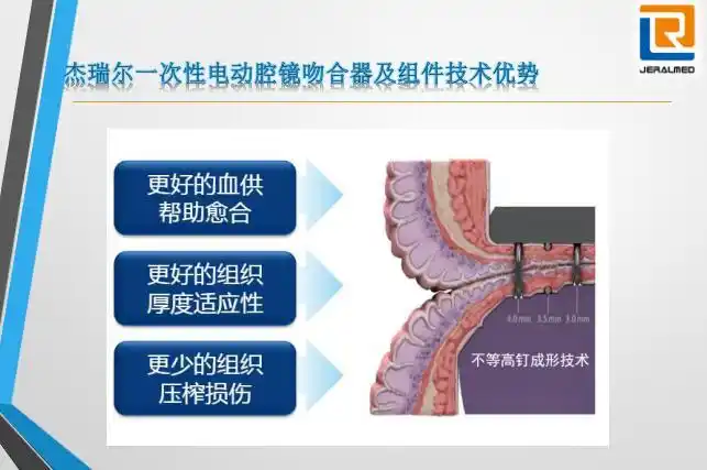 直线切割腔镜吻合器
