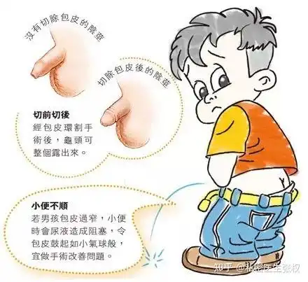 包茎畸形的病因临床表现以及治疗方法有哪些
