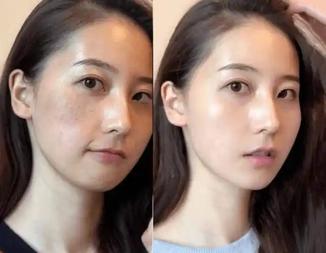 淡斑效果最好的护肤品有哪些,口碑之作看这款_祛斑_肌肤_斑点