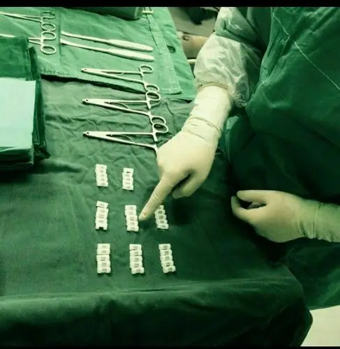 每台手术器械用物的清点