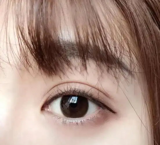 4种受欢迎的双眼皮形状,平行型公认最好看,平扇形颜值高,你呢