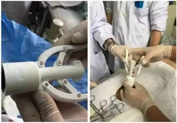 同的手术方式,决定具体价格如果采用传统的手工切开缝合进行包皮环切