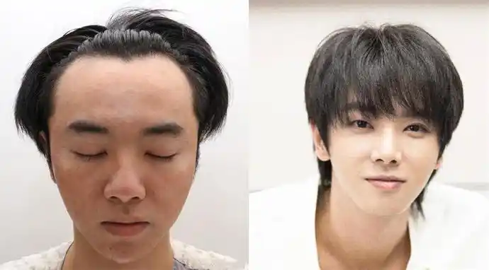 华晨宇声明意外透漏的细节:否认整容植发,承认图片是华晨宇本人