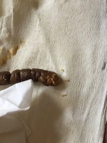 获赞数:6100lv16 擅长:宠物 向ta提问私信ta  展开全部 这应该是绦虫