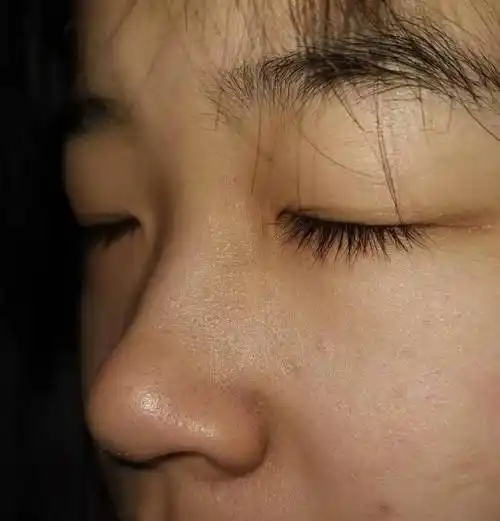 肤色暗沉发黄是为啥祛黄水乳推荐提亮肤色美白去黄一步到位