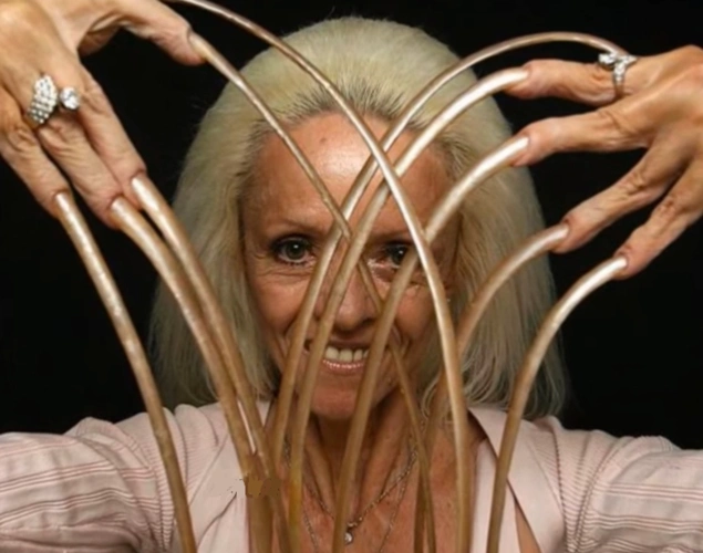 指甲留到8米长,毁于车祸好可惜