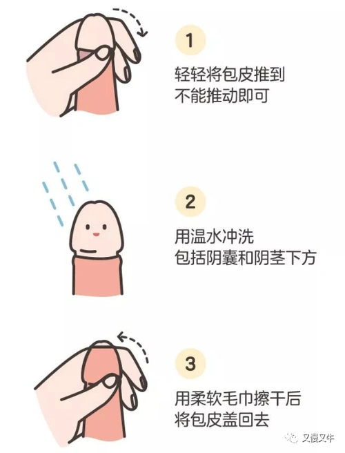 龟头是哪里包茎自翻步骤图片