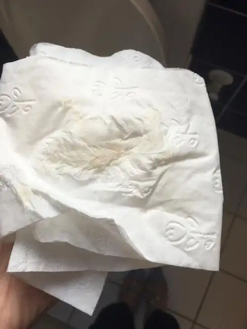 姐妹们帮我看看吧,排卵后今天出血了;(有图慎入)