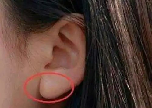 长什么样"耳朵"的人有福气和财气!