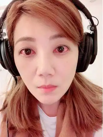 梁静茹发了一张照片网友吓坏为谁哭红了眼