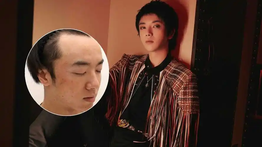 女生晒华晨宇素颜照曝他整容整鼻子削骨打下巴