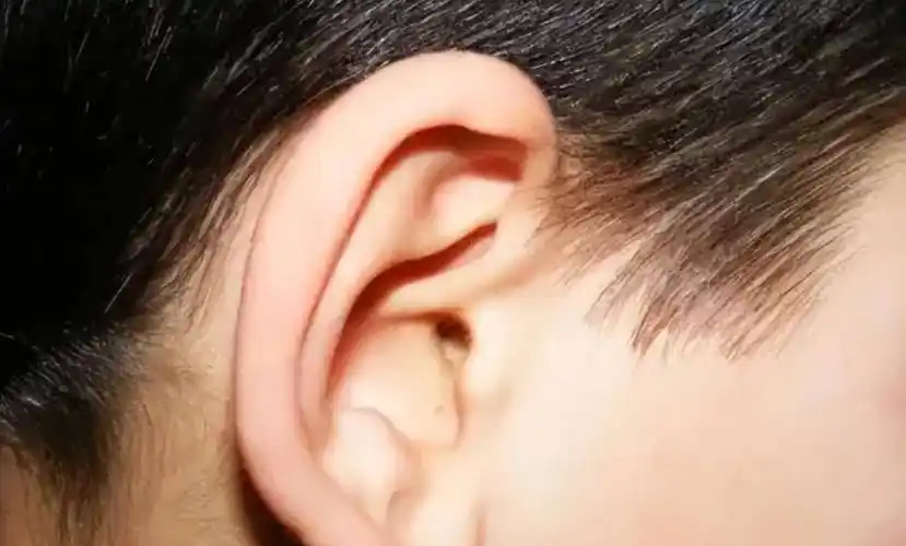 耳朵不同命不同?"穷人耳""富人耳"有啥差别?