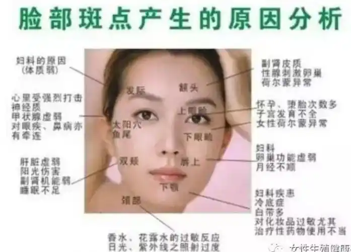 斑是写在女人脸上的"病",你病了吗?