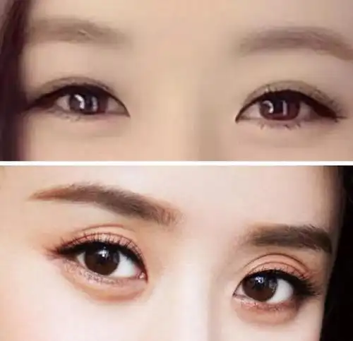 当下流行的五种双眼皮形态哪一种适合你
