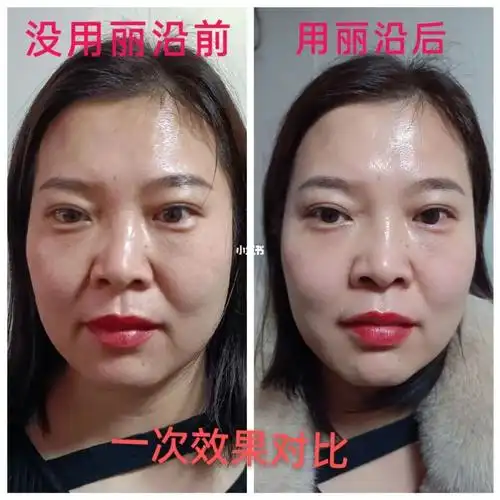 丽沿紧致抗皱活泉水喷一次3分钟后效果对比