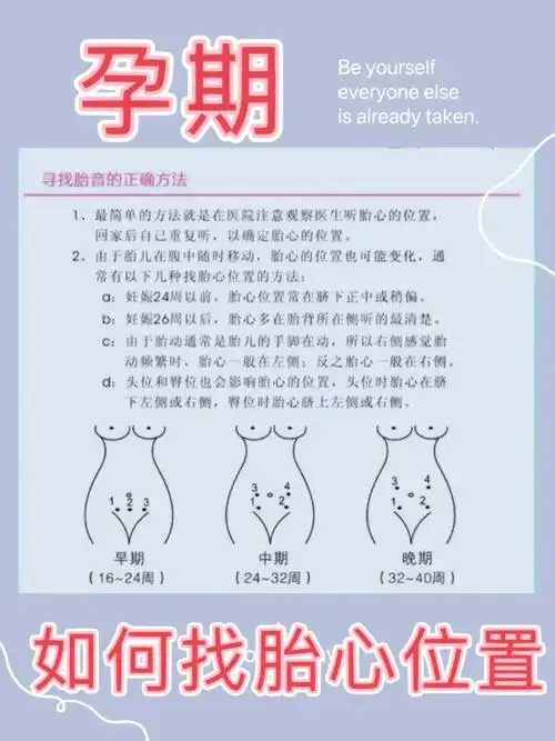 孕期如何找胎心位置太准了