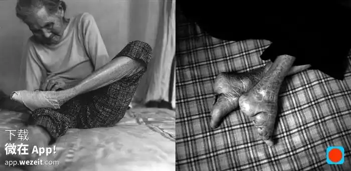 中国现在还有缠小脚的女人和她们的故事