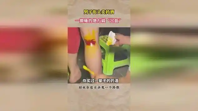 男子街头卖药酒,一擦痛的地方竟会"出血"!|女性|醉酒