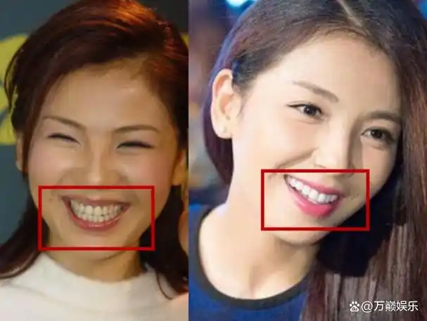 明星"烤瓷牙"有多拉垮?嘴凸显老,嘴包不住牙,演戏都没法看了