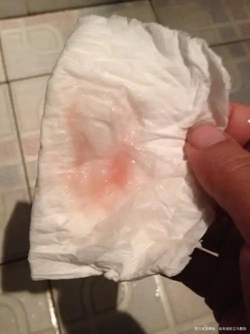 认认真真!排卵期出血怎么治疗"意味深长"-第2张图片-凝残月网