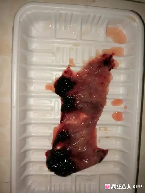 刚刚自然流产,姐妹们帮忙看看是这个吗?有图,慎入