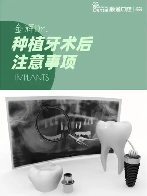 口腔科普种植牙术后注意事项