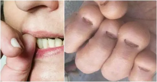 男子从小就喜欢「咬指甲」,最后这个坏习惯却「害他惨死」!