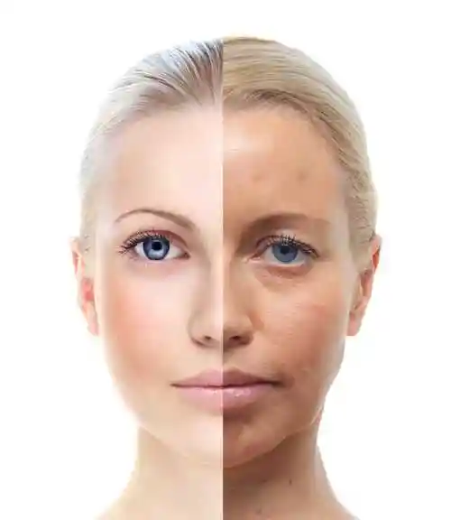 女人皮肤美白概念