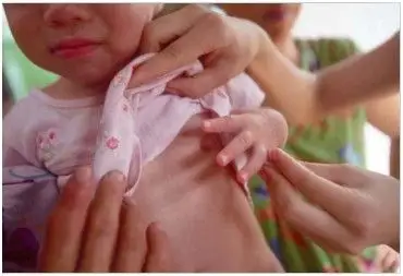 儿童性早熟一般多表现于外在和声音上的变化,女孩多为乳房开始发育