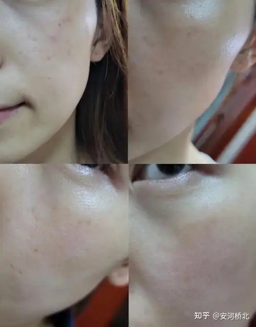 美容院的人平时都用什么护肤品怎么能用最少的钱保养皮肤